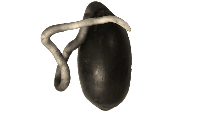 The picture shows an acorn germinating with a crooked taproot.